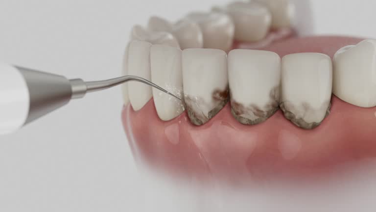 Trusted Teeth Whitening service in Bay Minette, AL - Dentist Open Now